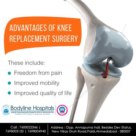 joint replacement near hercules